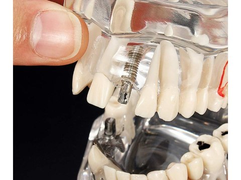 Edukacyjny model stomatologiczny do nauki anatomii zębów