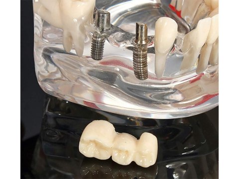 Edukacyjny model stomatologiczny do nauki anatomii zębów