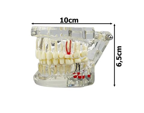Edukacyjny model stomatologiczny do nauki anatomii zębów