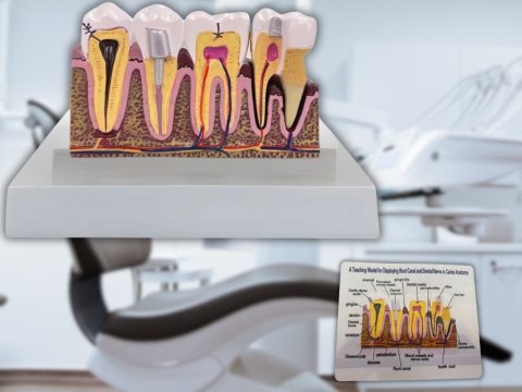 Nowoczesny model anatomiczny zęba - edukacja i prezentacja patologiami