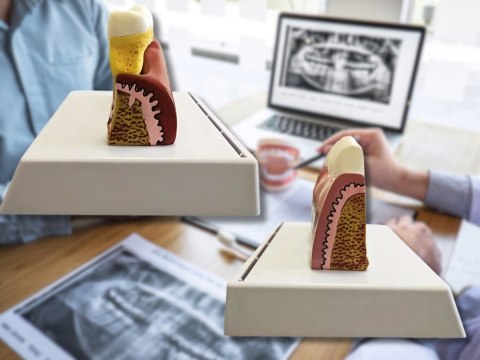 Nowoczesny model anatomiczny zęba - edukacja i prezentacja patologiami